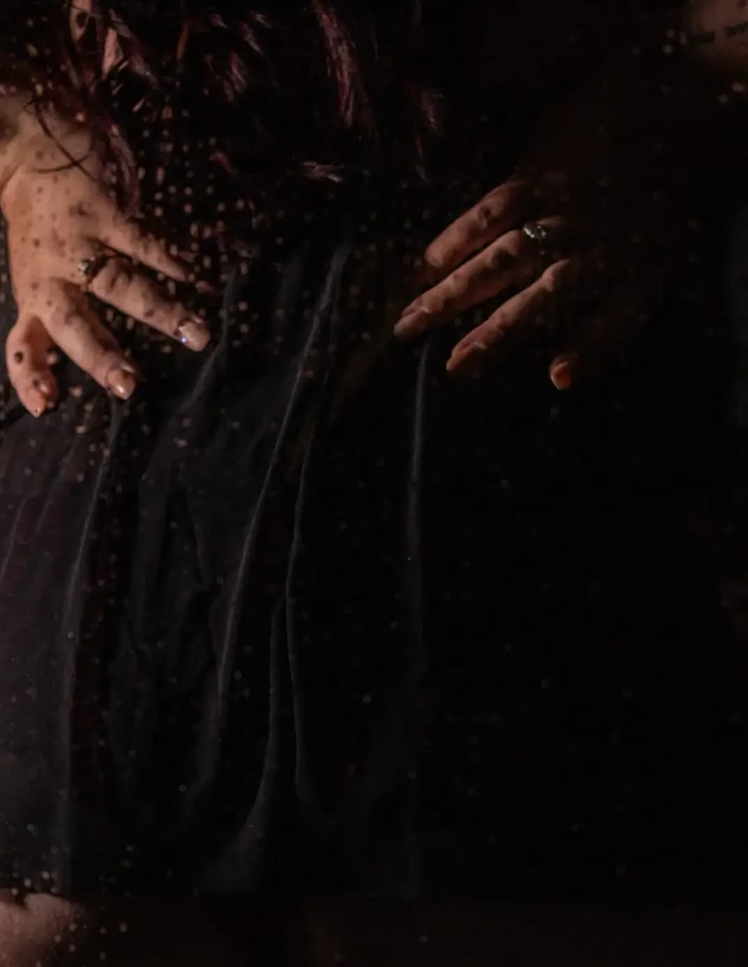 Lyssa image