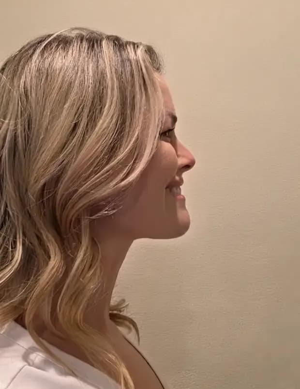 Alli Brinkman image