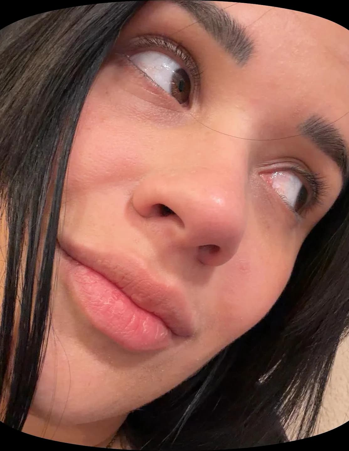 Melisa image